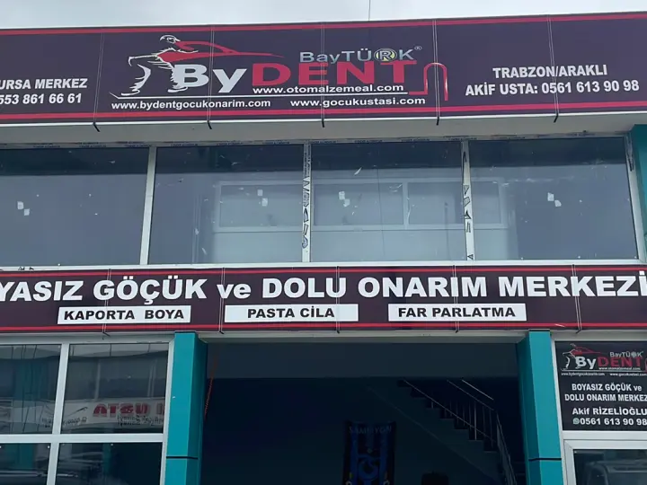 ByDENT Boyasız Göçük Onarım - Göçükçü Akif