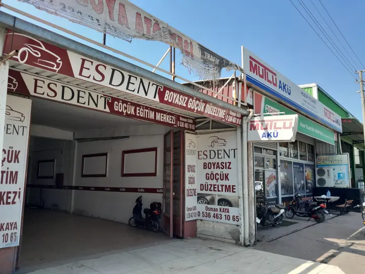 Esdent Boyasız Göçük Düzeltme