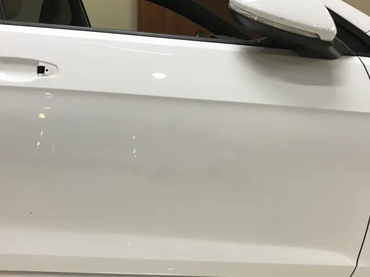 Göçük Hospital Boyasız Göçük Düzeltme İzmir