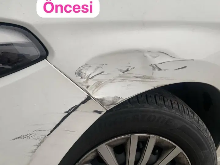 OSCAR Boyasız Göçük Düzeltme
